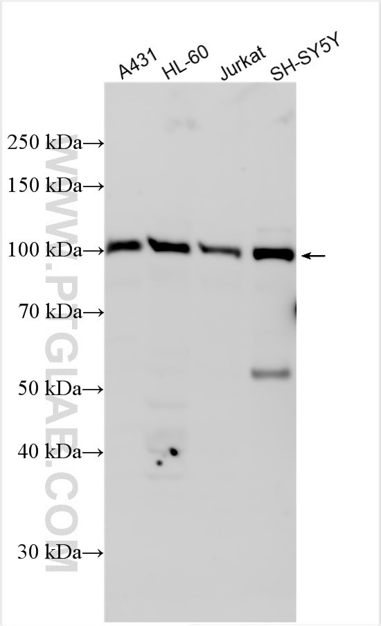 FAAP100 Antibody in Western Blot (WB)