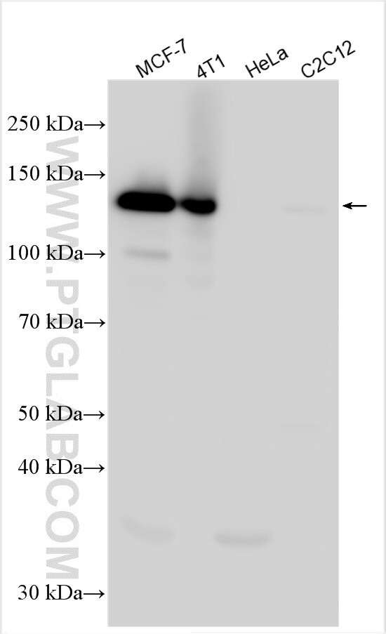 CEP104 Antibody in Western Blot (WB)