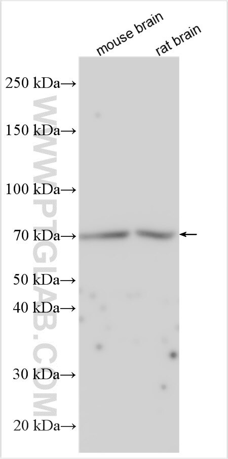 SLX4 Antibody in Western Blot (WB)