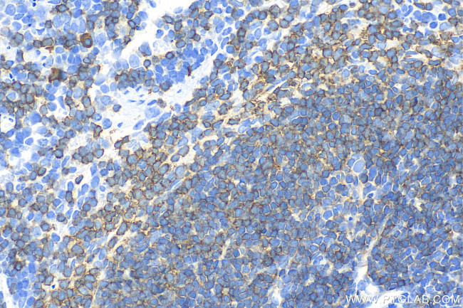 CD79a Antibody in Immunohistochemistry (Paraffin) (IHC (P))