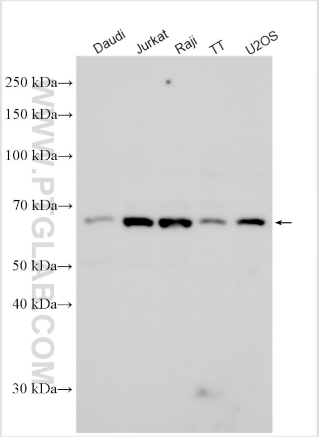 KCNA6 Antibody in Western Blot (WB)