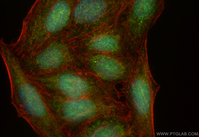 TRNT1 Antibody in Immunocytochemistry (ICC/IF)