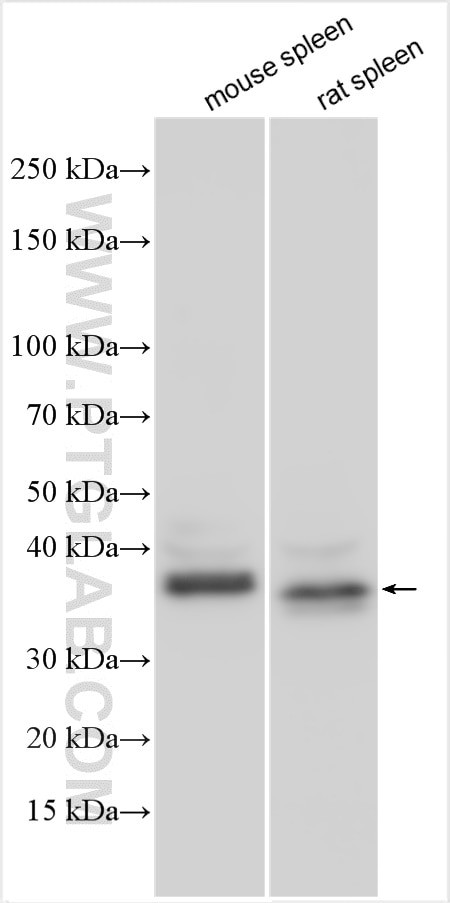 FRMD1 Antibody in Western Blot (WB)
