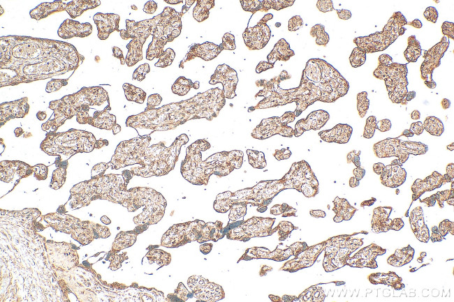 TMEM143 Antibody in Immunohistochemistry (Paraffin) (IHC (P))