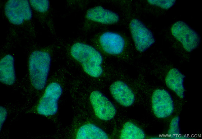 CHD7 Antibody in Immunocytochemistry (ICC/IF)