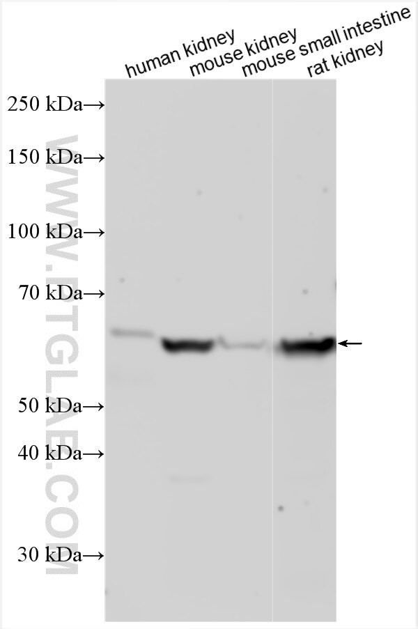ATL1 Antibody in Western Blot (WB)