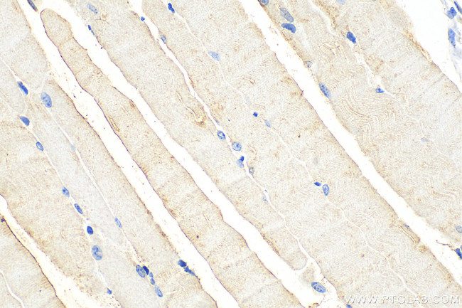 CLEC2L Antibody in Immunohistochemistry (Paraffin) (IHC (P))