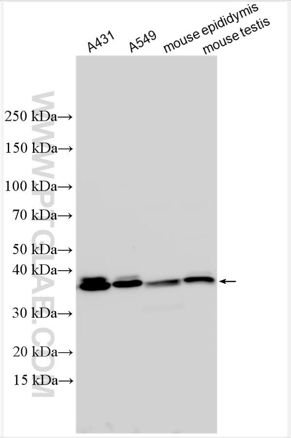 FCAMR Antibody in Western Blot (WB)