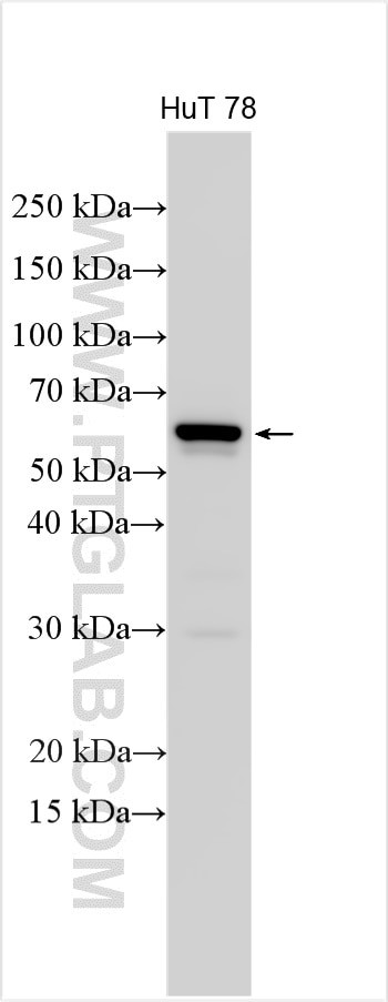 KIR2DL2 Antibody in Western Blot (WB)