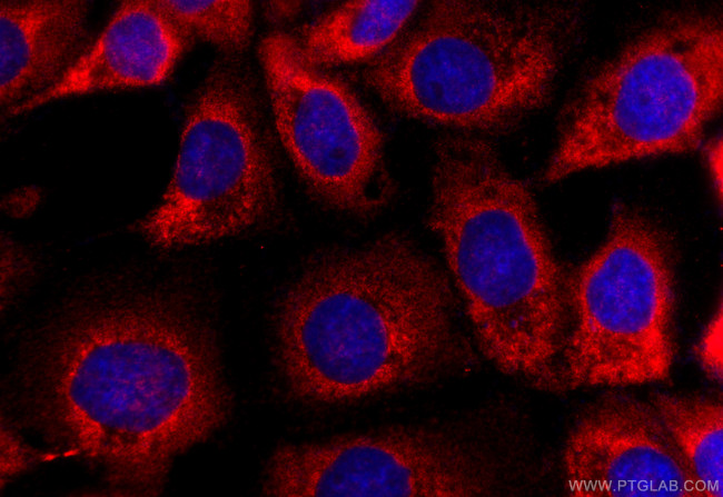 SPINT3 Antibody in Immunocytochemistry (ICC/IF)