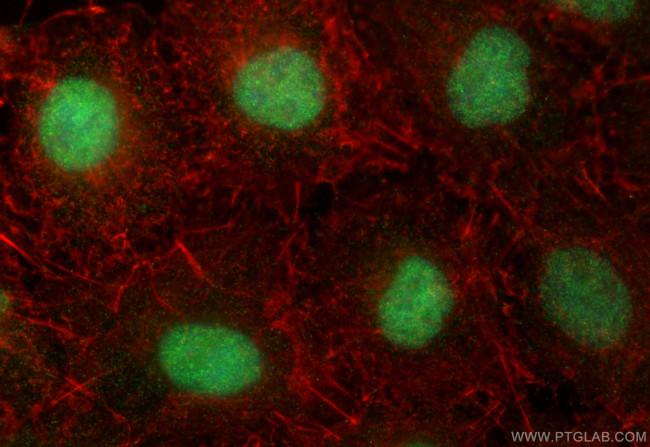 ZNF618 Antibody in Immunocytochemistry (ICC/IF)