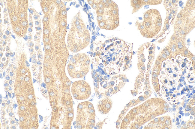 SUCNR1 Antibody in Immunohistochemistry (Paraffin) (IHC (P))