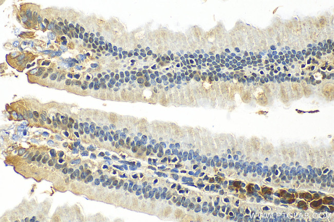 ANP32E Antibody in Immunohistochemistry (Paraffin) (IHC (P))