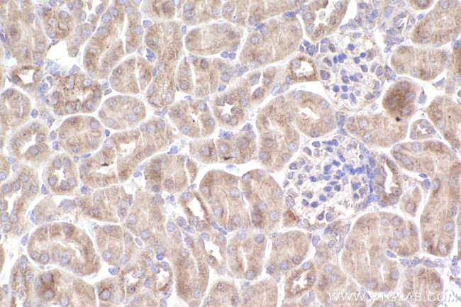 DOCK11 Antibody in Immunohistochemistry (Paraffin) (IHC (P))