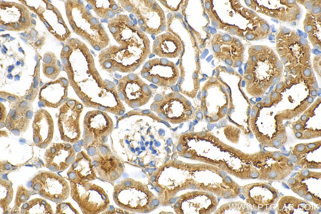 SLC7A13 Antibody in Immunohistochemistry (Paraffin) (IHC (P))