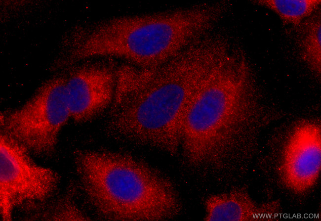 HECW2 Antibody in Immunocytochemistry (ICC/IF)