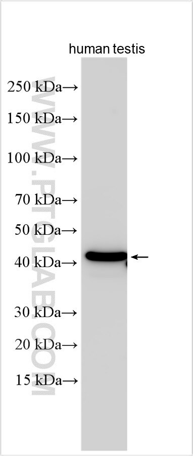 TCF20 Antibody in Western Blot (WB)