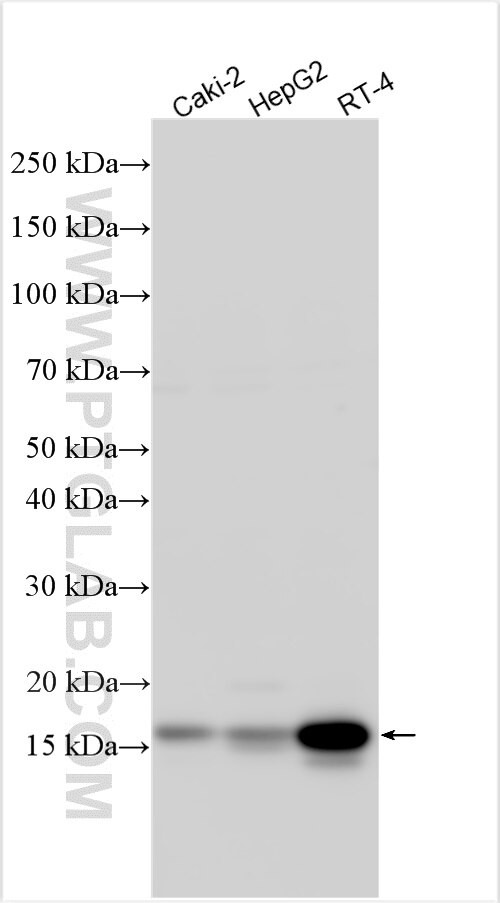 RSPH1 Antibody in Western Blot (WB)