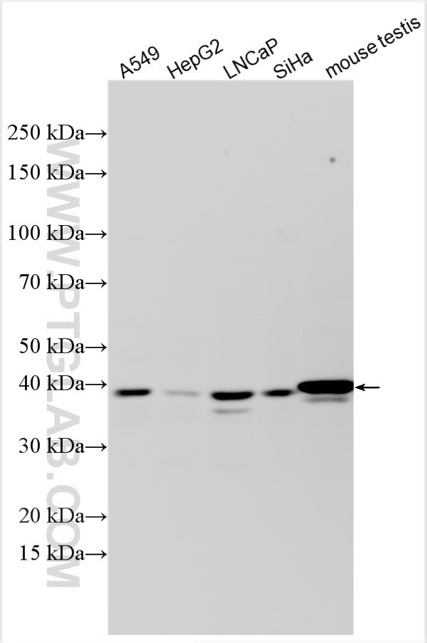 ABHD4 Antibody in Western Blot (WB)