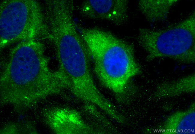 AMN Antibody in Immunocytochemistry (ICC/IF)