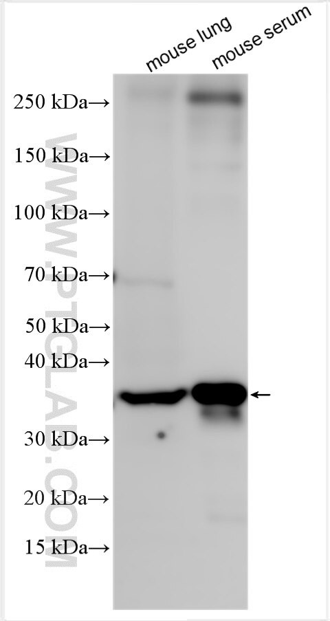 Factor IX/PTC Antibody in Western Blot (WB)