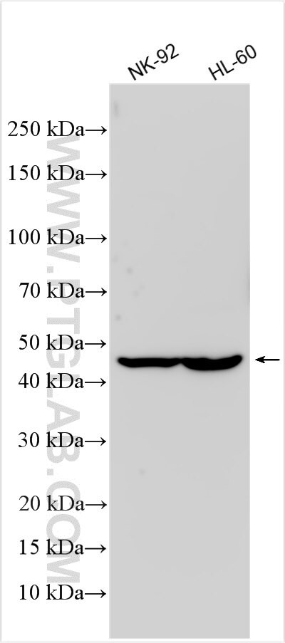 CSF2RA/CD116 Antibody in Western Blot (WB)