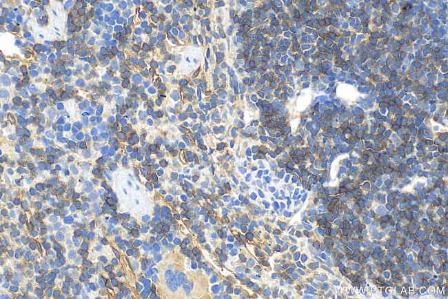 CD55 Antibody in Immunohistochemistry (Paraffin) (IHC (P))