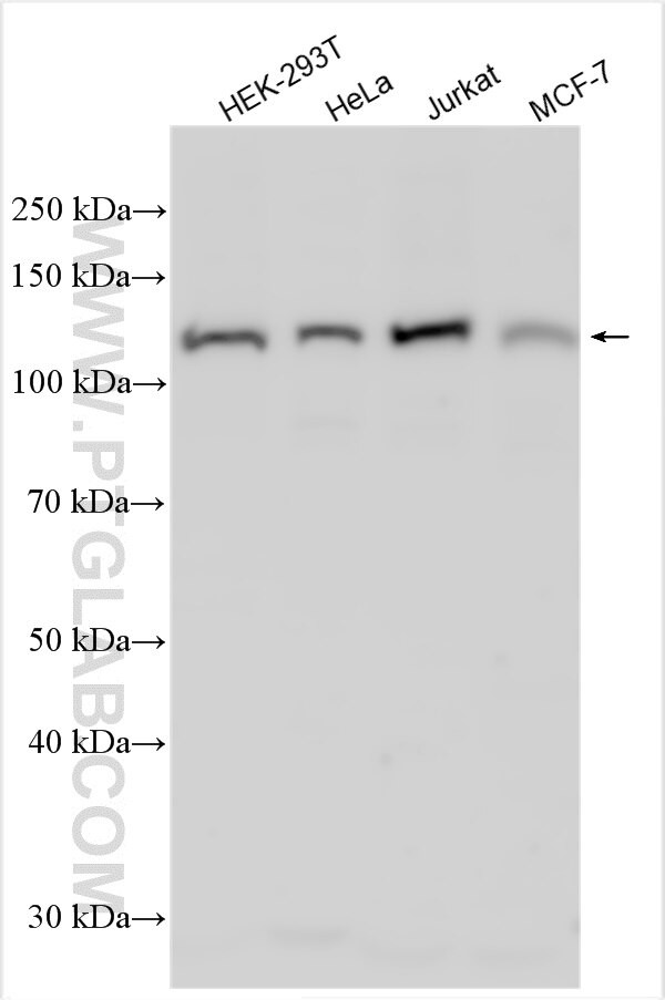 FBXO16 Antibody in Western Blot (WB)