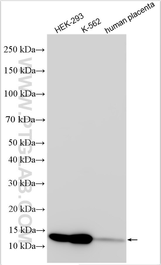 SLC66A2 Antibody in Western Blot (WB)