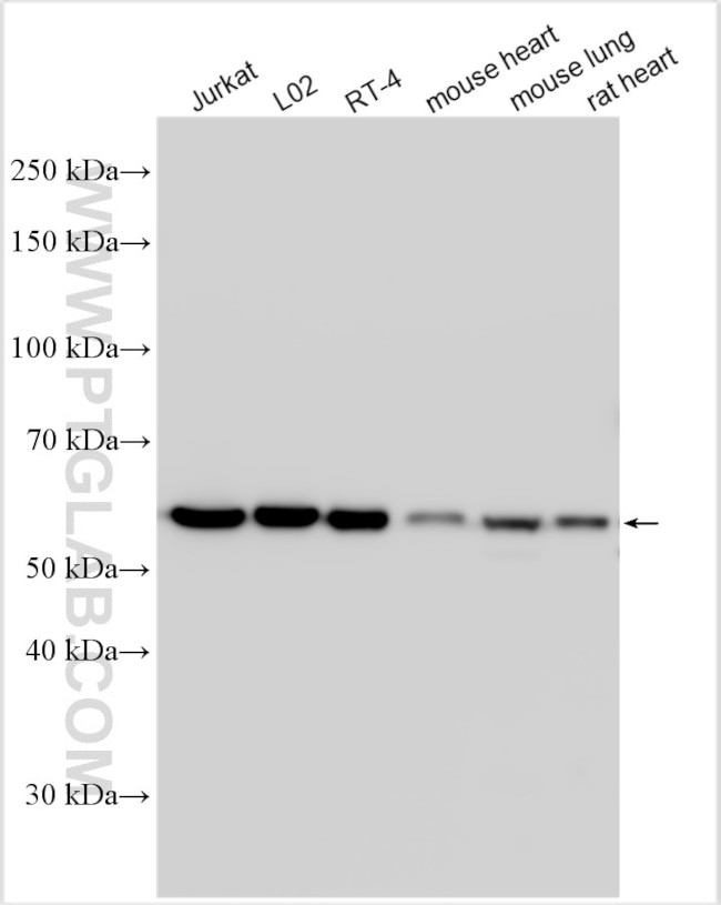 CCDC47 Antibody in Western Blot (WB)