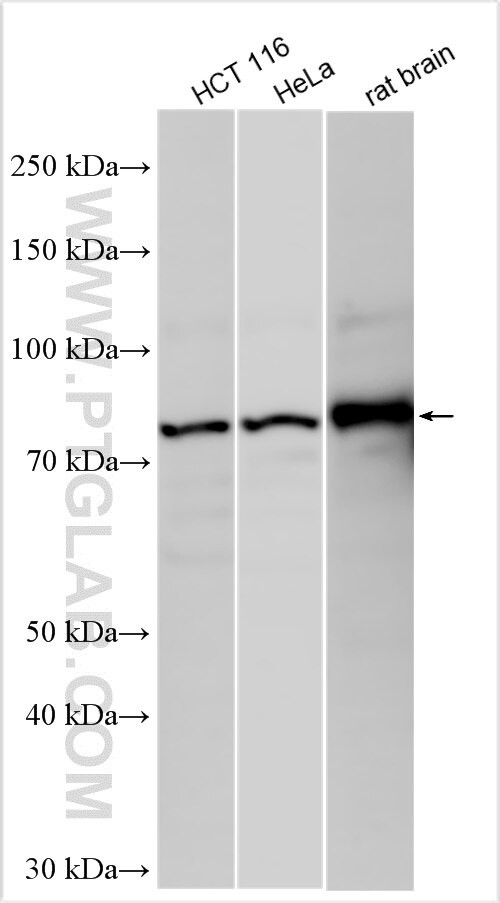 ACP6 Antibody in Western Blot (WB)