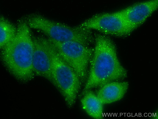 CD2AP Antibody in Immunocytochemistry (ICC/IF)