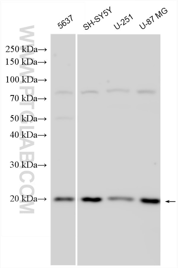 C2orf69 Antibody in Western Blot (WB)