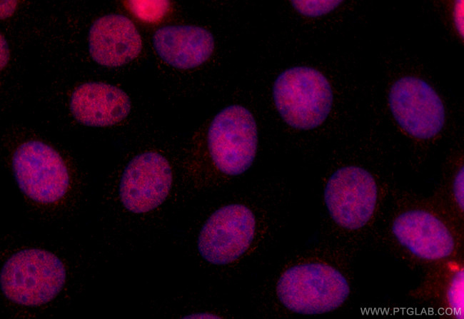BCL9L Antibody in Immunocytochemistry (ICC/IF)