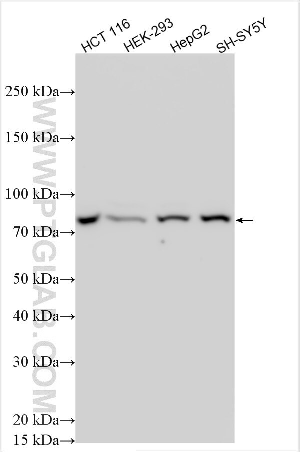 SPATA5 Antibody in Western Blot (WB)