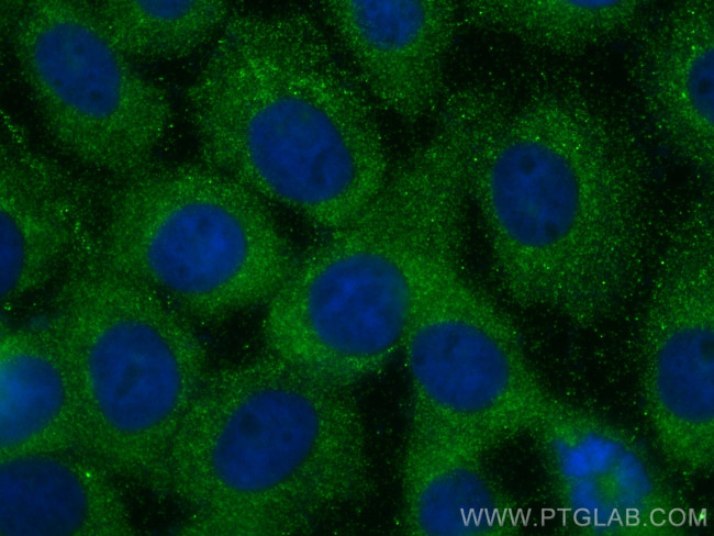 LRRC45 Antibody in Immunocytochemistry (ICC/IF)