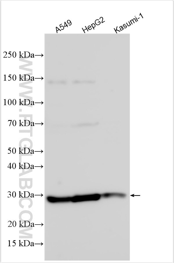 NSMCE1 Antibody in Western Blot (WB)