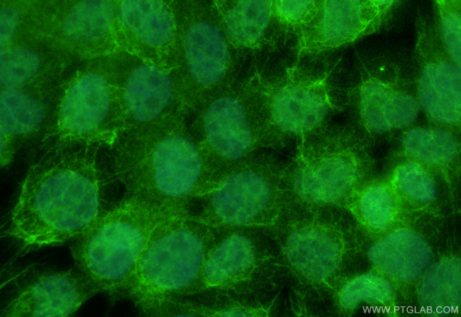 DGKZ Antibody in Immunocytochemistry (ICC/IF)