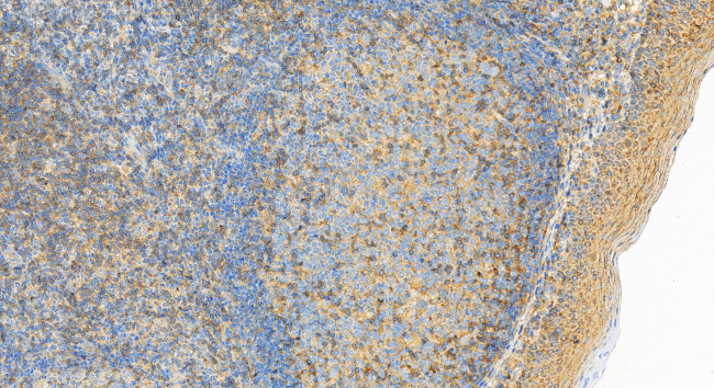 CD3 Delta Antibody in Immunohistochemistry (Paraffin) (IHC (P))