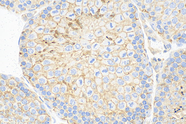 Nectin-2/CD112 Antibody in Immunohistochemistry (Paraffin) (IHC (P))