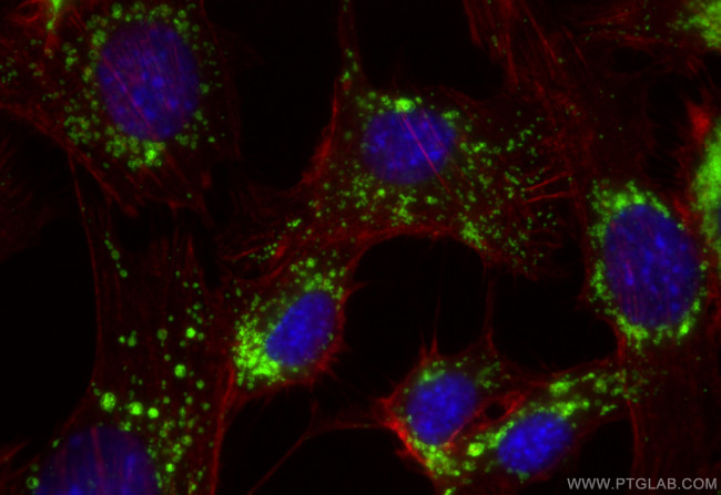 CD107b/LAMP2 Antibody in Immunocytochemistry (ICC/IF)