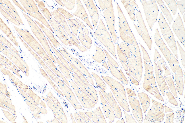 OSBPL6 Antibody in Immunohistochemistry (Paraffin) (IHC (P))