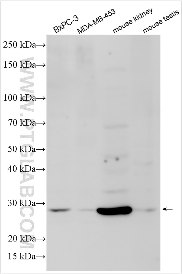 UBFD1 Antibody in Western Blot (WB)