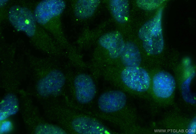 TOM1L2 Antibody in Immunocytochemistry (ICC/IF)