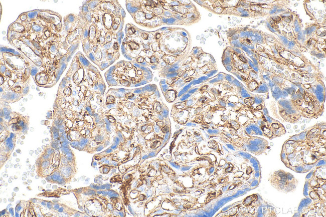 CD36 Antibody in Immunohistochemistry (Paraffin) (IHC (P))