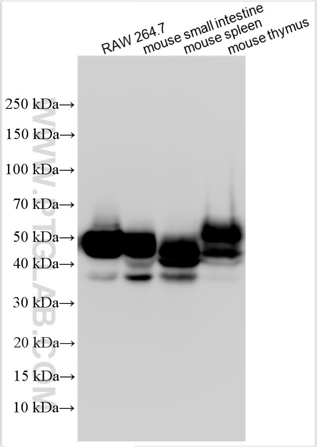 gp130/IL6ST Antibody in Western Blot (WB)