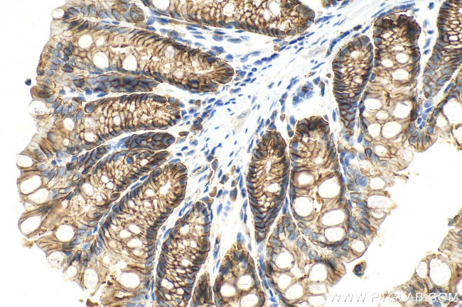 EPCAM/CD326 Antibody in Immunohistochemistry (Paraffin) (IHC (P))