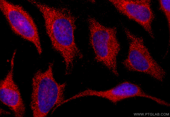 SLPI Antibody in Immunocytochemistry (ICC/IF)