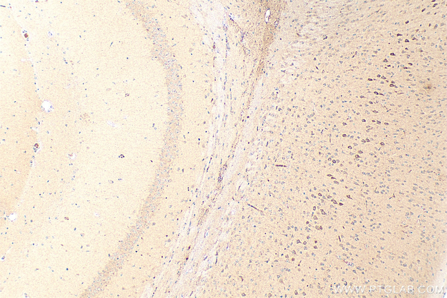 C1QL2 Antibody in Immunohistochemistry (Paraffin) (IHC (P))