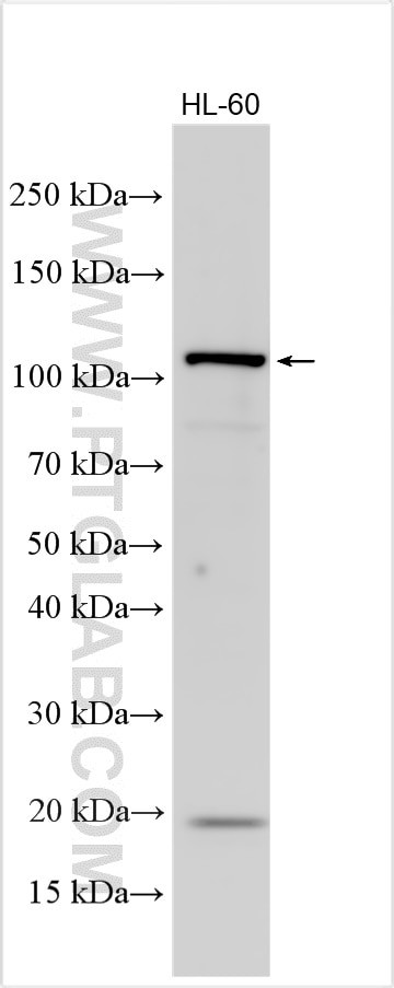 ABL1 Antibody in Western Blot (WB)